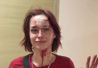 В Одесі військовослужбовець ТЦК побив милицею дівчину (відео, фото)