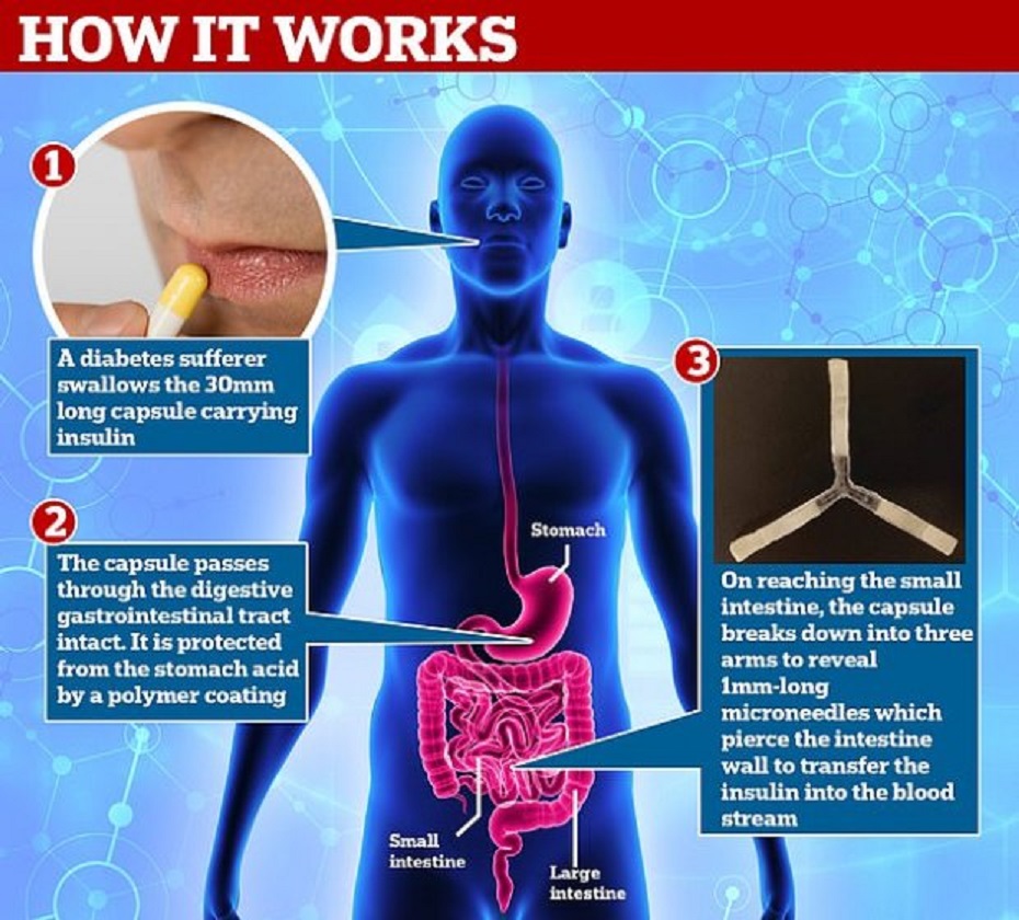 Как работает капсула от диабета
