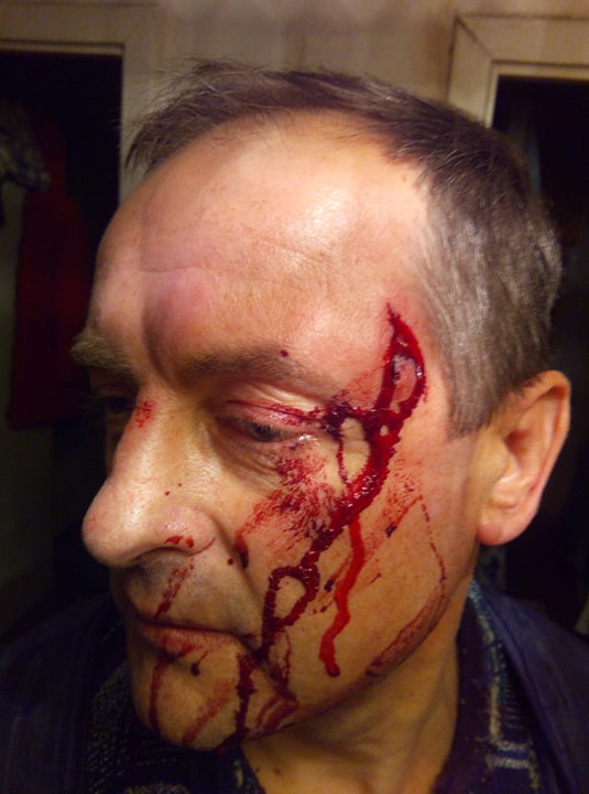 На Житомирщине депутата жестоко избили молотком