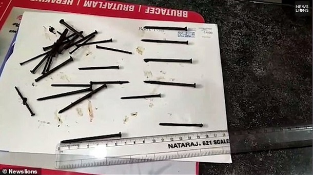 Индус проглотил 116 гвоздей и провод