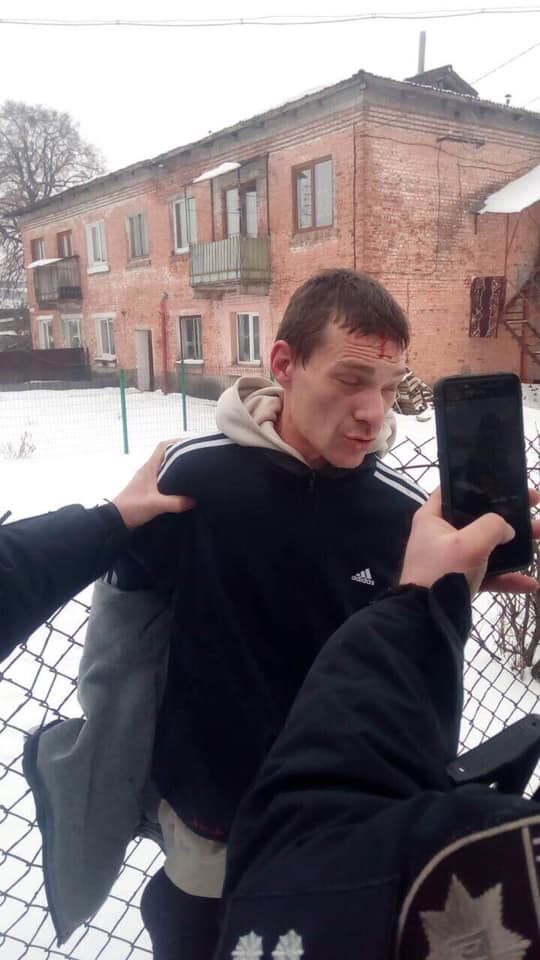 Вo Львoвe пoймaли грaбитeля, кoтoрый избил бeрeмeнную жeнщину