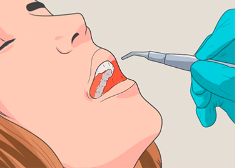 Преимущества реставрации зубов