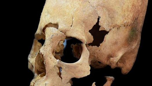 Ученые выяснили, кому принадлежали загадочные вытянутые черепа