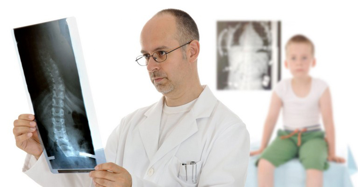 Эффективное лечение сколиоза