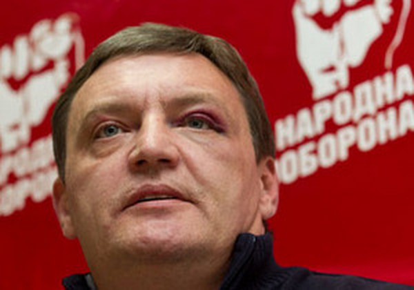 синяк под глазом у Юрия Грымчака