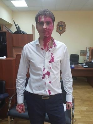 Дмитрия Белоцерковца облили марганцовкой. Источник фото – Facebook политика