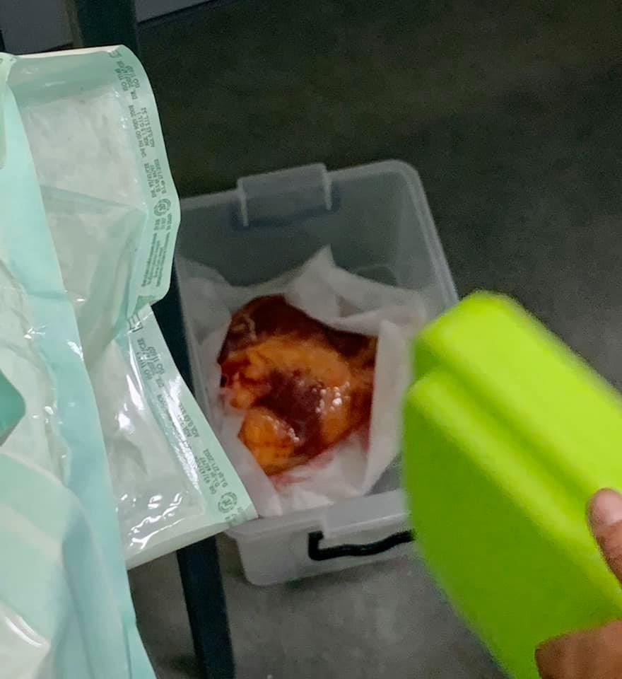 Пересадка сердца в Украине 