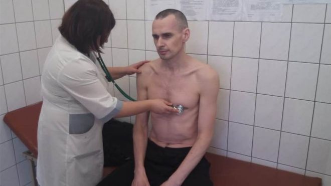 Олег Сенцов на приеме у врача