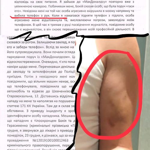 Журналист, на которого напал охранник главы поселкового совета, требует переквалифицировать дело