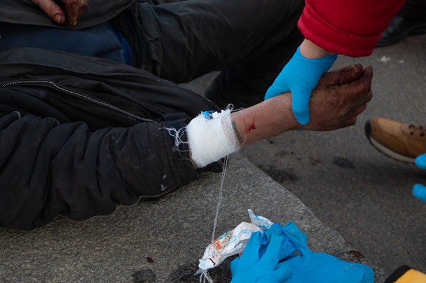 В Днепре подростки жестоко избили бездомных