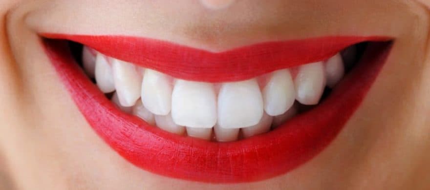 Эксперты рассказали, как отбелить зубы в домашних условиях