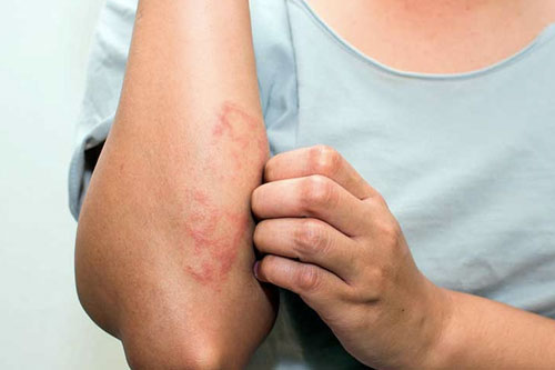 Кожные заболевания, которые можно вылечить с помощью дерматологических препаратов