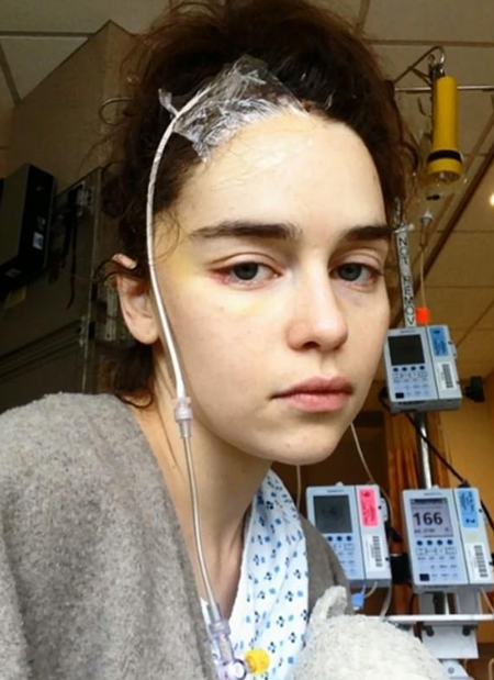 Эмилия Кларк в больнице после инсульта