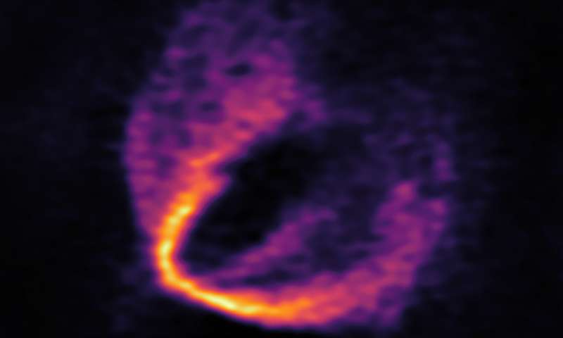 Иллюстрация из набора данных ALMA с нарушением в движении газа. Credit: ESO, ALMA (ESO/NAOJ/NRAO)