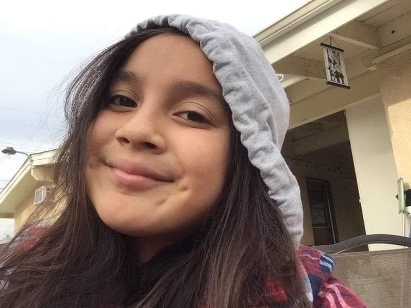 11-летняя девочка умерла от аллергии на зубную пасту