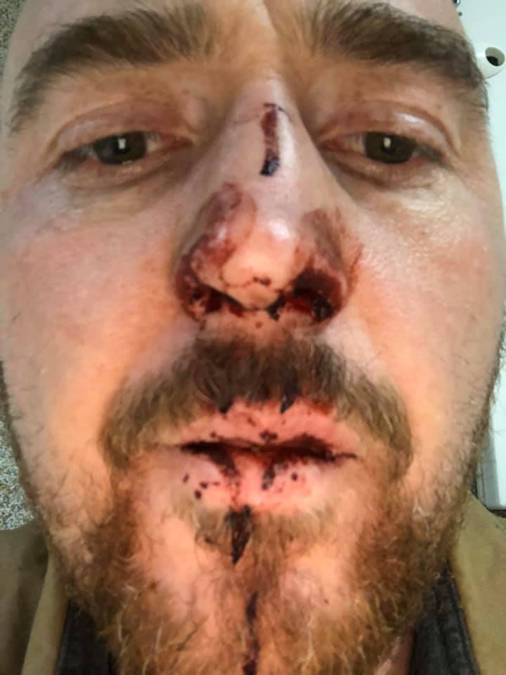 Актера-заробитчанина из Украины избили в Польше