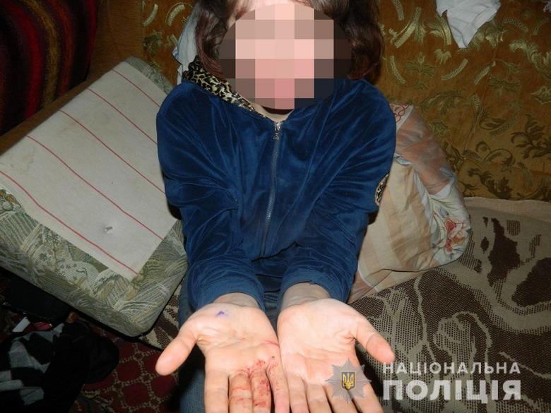 В Киеве женщина порезала брата, защищая мать