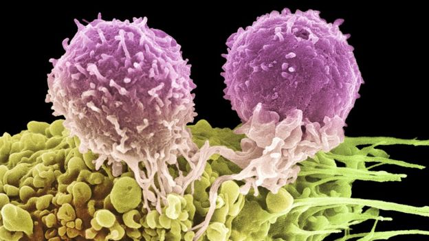 два Т-лимфоцита, атакующие раковую клетку