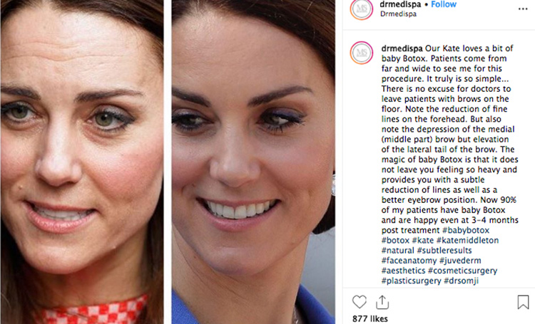 Кейт Миддлтон