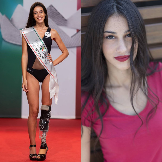 Одноногая девушка прошла в финал конкурса Мисс Италия