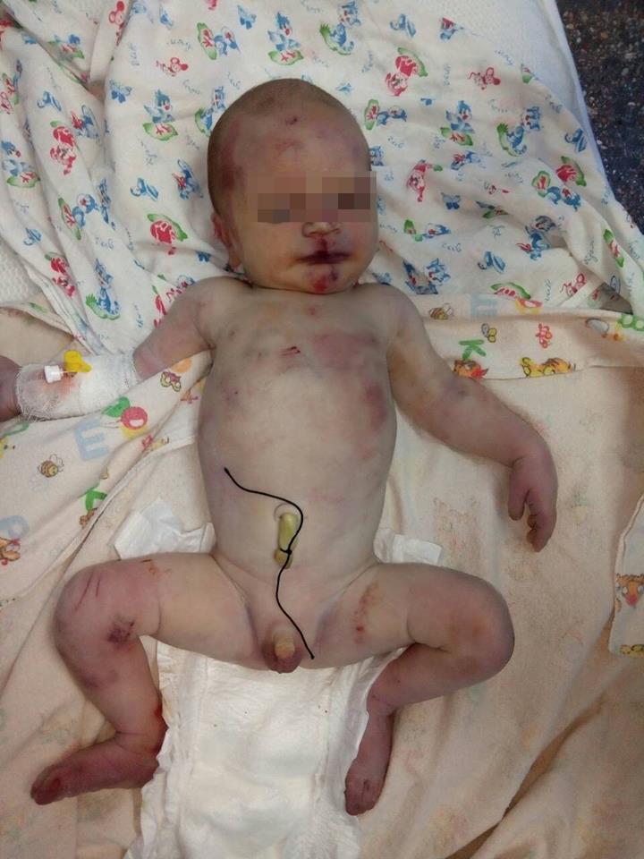 Под больницу в Первомайске подбросили новорожденного ребенка