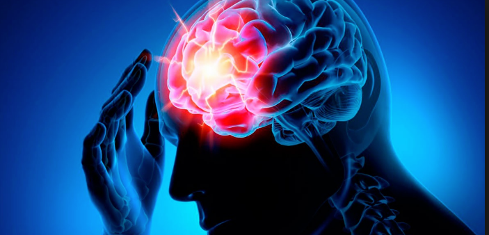 Врачи назвали способы предотвращения инсульта