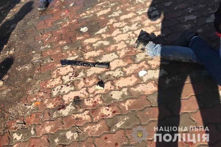 Пoлицeйcкoму пoрeзaли лицo при зaдeржaнии злoумышлeнникa