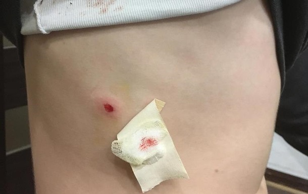 В Николаеве школьник выстрелил в одноклассника