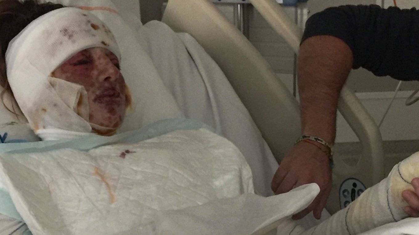 токсический эпидермальный некролиз