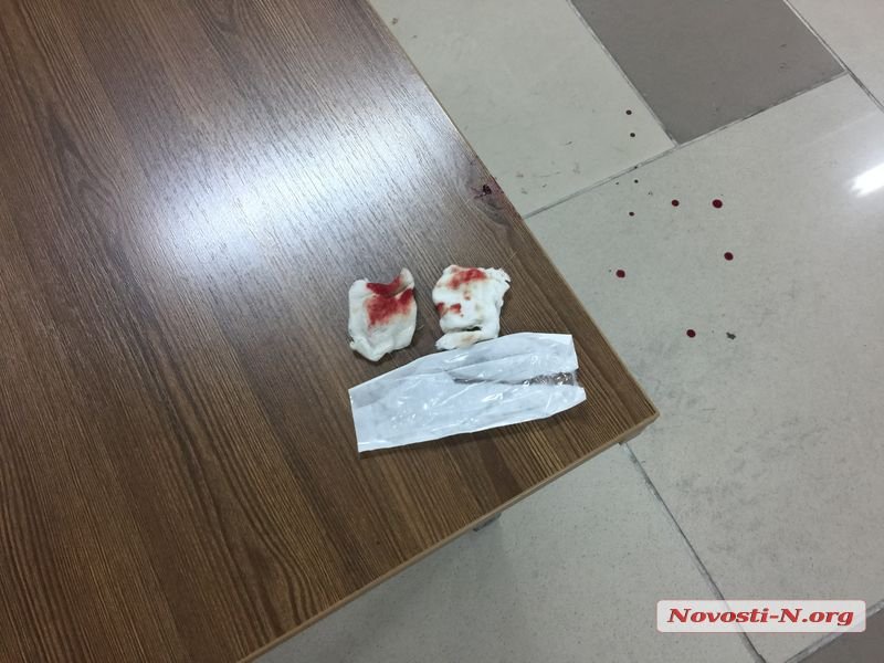В Николаеве подсудимый порезал вены в зале суда