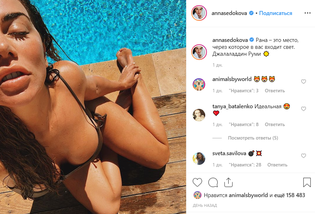 Анна Седокова вспомнила о сердечной ране и показала грудь