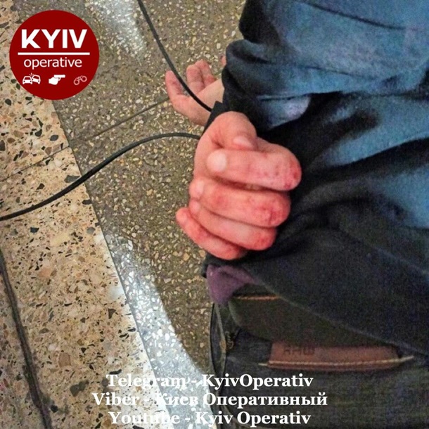 В Киеве пациенты больницы утроили поножовщину