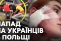 У Вроцлаві затримано ймовірних нападників на українців: "Гангстер" та "футбольний хуліган" серед підозрюваних