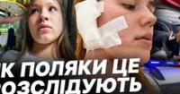 Зростання нападів на українців у Польщі: статистика, реакція влади та суспільні настрої