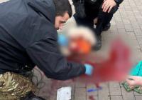 Бігла спускатися в метро: жінку з уламком в голові ушпиталили в тяжкому стані у Києві (фото, відео)