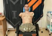 "ПриватБанк" після відмови видати картку ветерану без рук відкуповується: пропонує протезування та лікування