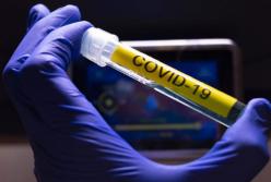 Кабмин разработает механизм компенсации за негативные последствия вакцинации