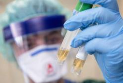 Динамика распространения COVID-19 внушает оптимизм