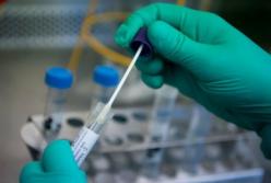 4 сценарії розвитку COVID-19. З чим ми запізнилися і що потрібно робити негайно