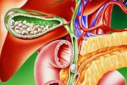 Медики подсказали, как распознать заболевания печени