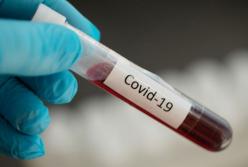 Коронавирус отступает?