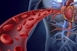 Как избежать смертельной болезни сосудов