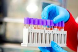 Тест на антитела: как оценить иммунный ответ COVID-19?