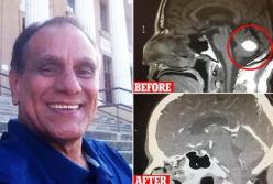 Опухоль головного мозга этого мужчины неожиданно исчезает за день до операции (видео)
