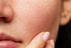 3 эффективных маски от расширенных пор