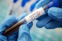 Штамм Дельта: когда Украине ждать новую волну COVID-19?