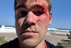 Владелец интернет-магазина избил клиента, которому продали ворованный планшет