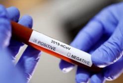 Каким тестам на коронавирус можно доверять?