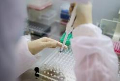 В Украине впервые за две недели менее 10 тысяч новых случаев коронавируса