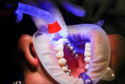 Медики назвали признаки рака ротовой полости